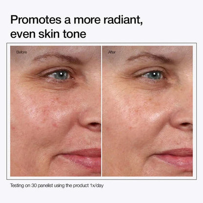 7% Glycolic Acid Toner - Exfoliating Face Toner for Blackheads & Glowing Skin (150ml)